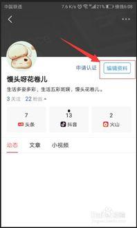 手机如何更改头条的昵称,教你如何更改今日头条昵称