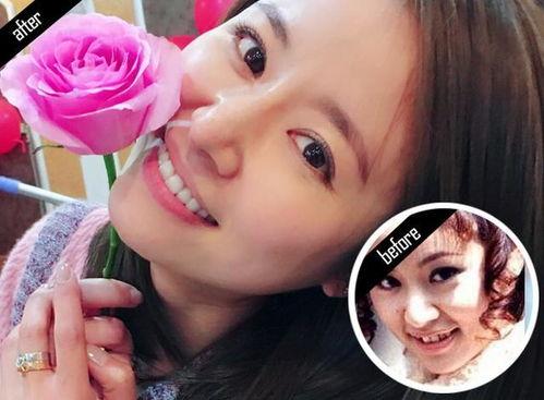 明星说牙齿,牙齿护理之道